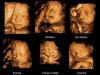 Foto de Gm imagenes ecografia general - 3d- doppler